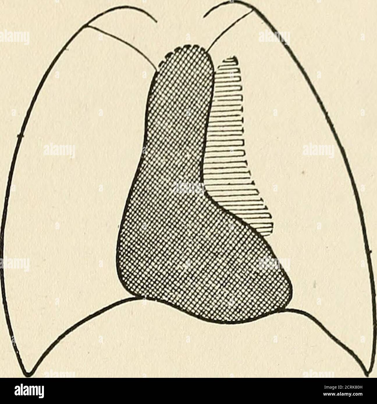 . Radio-diagnosis of pleuro-pulmonary affection . Fig. 15. ARTIFICIAL ...