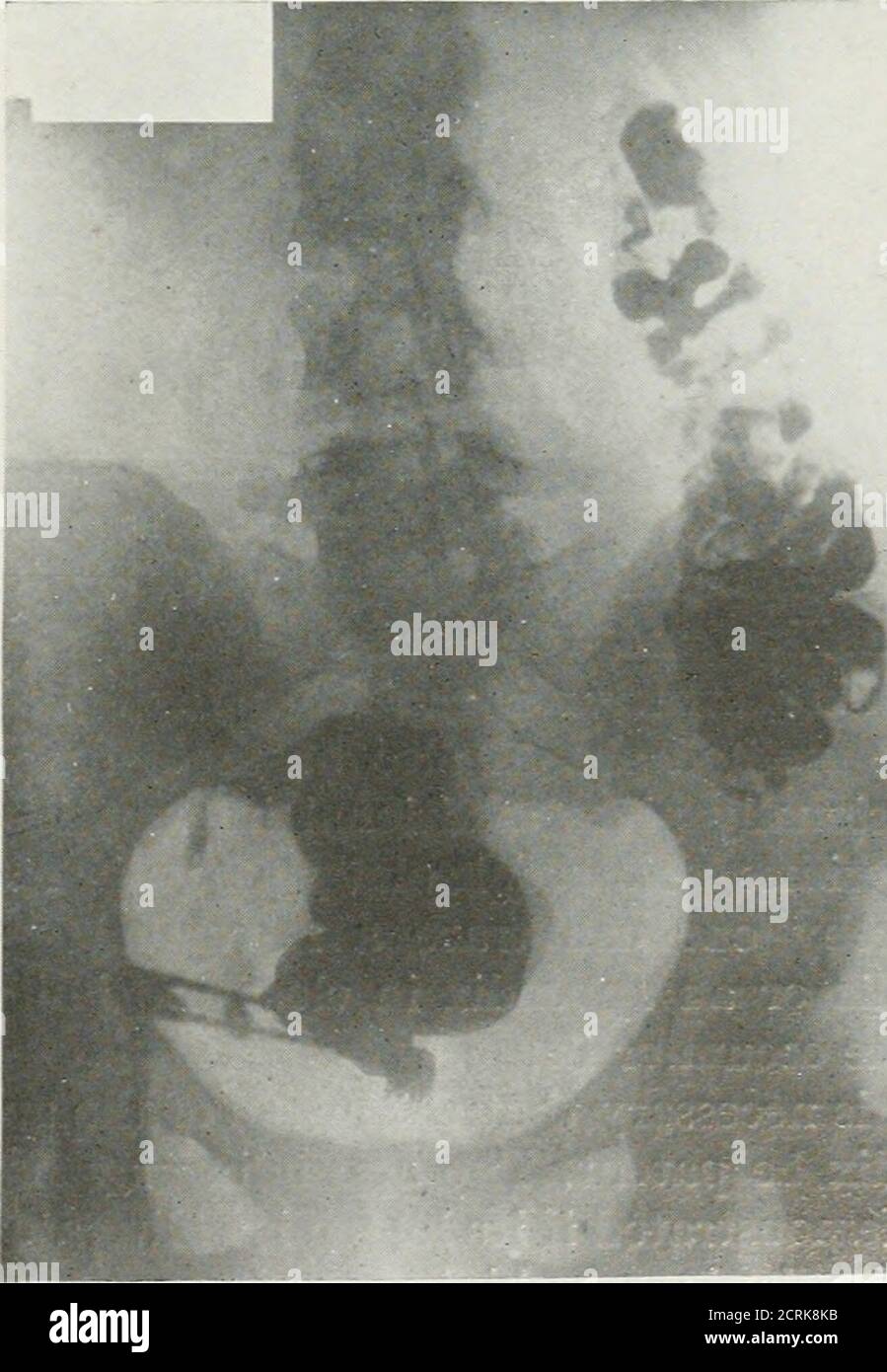 . The American journal of roentgenology, radium therapy and nuclear ...