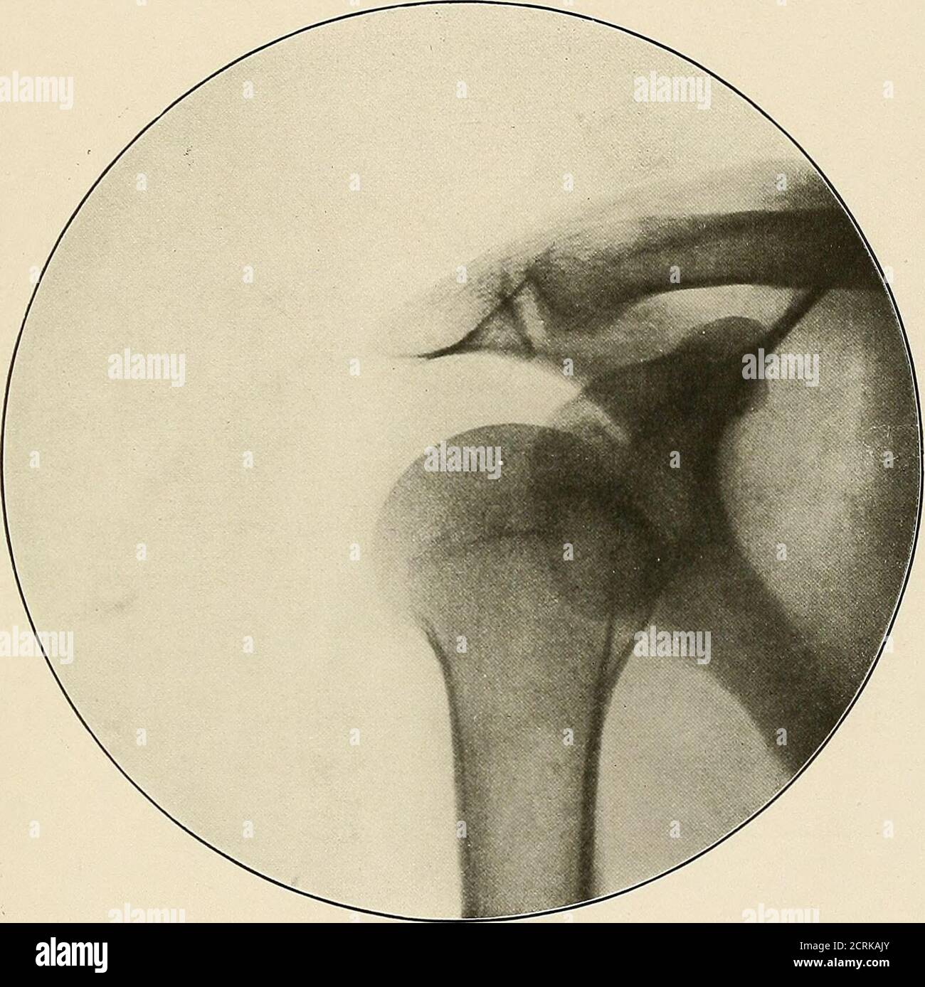 . A radiographic atlas of the pathologic changes of bones and joints