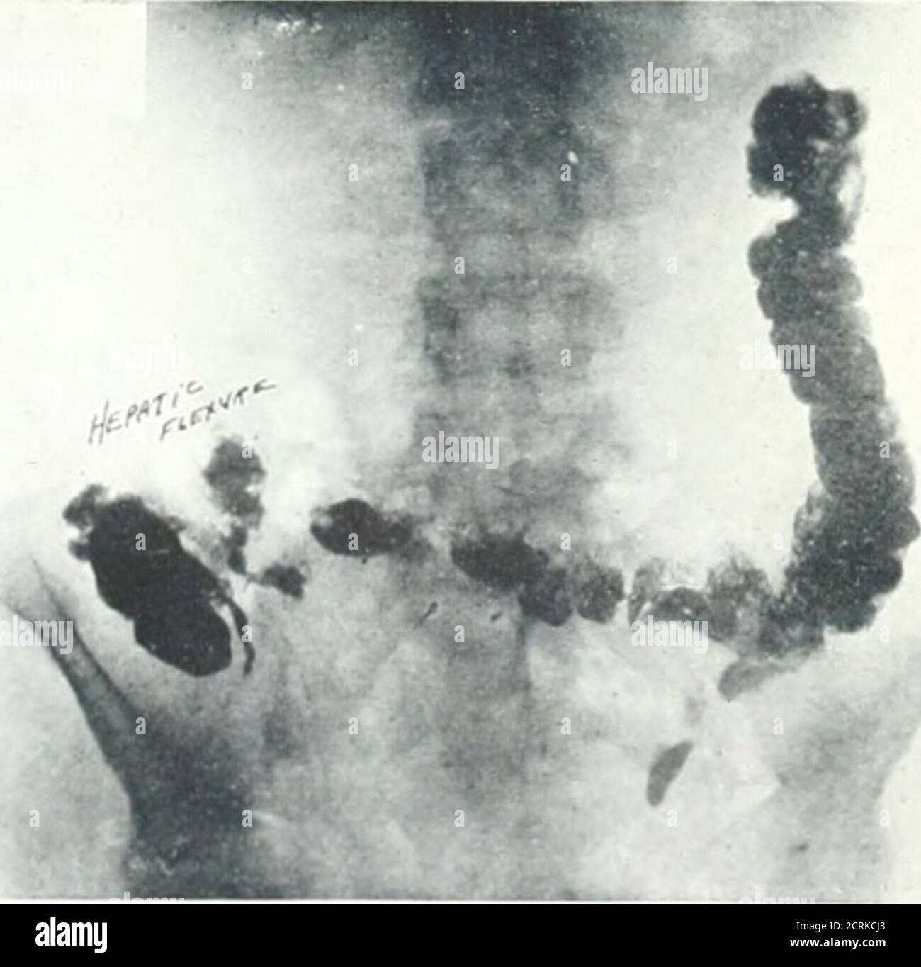 . Archives of physical medicine and rehabilitation . eal rotation the ...