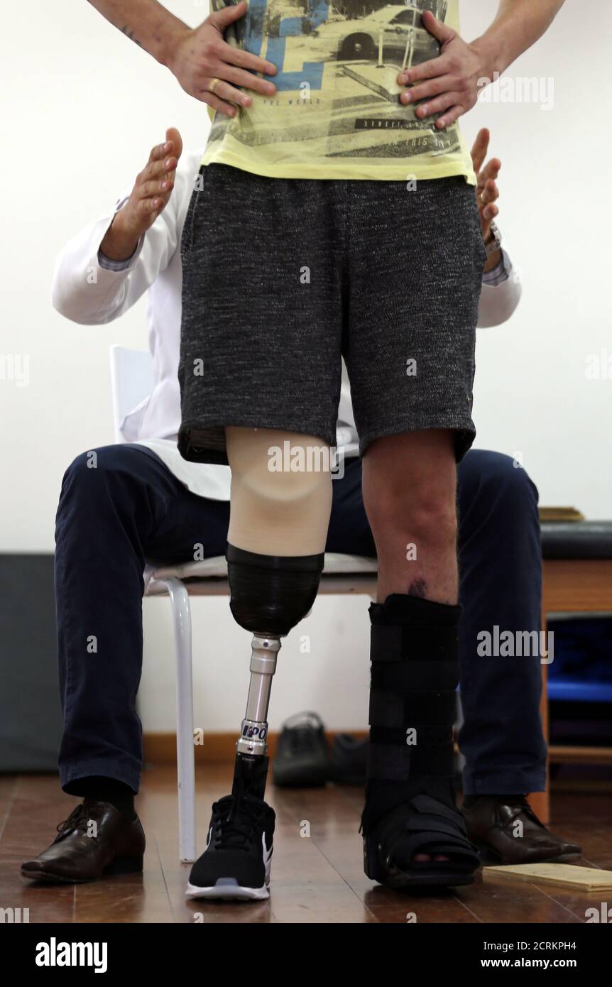 Goalkeeper Jackson Follmann (front), who survived when the plane carrying Brazilian soccer team Chapecoense crashed, talks with Dr. Jose Carvalho as they try on a prosthetic leg in Sao Paulo, Brazil, February 21, 2017. REUTERS//Paulo Whitaker Stock Photo