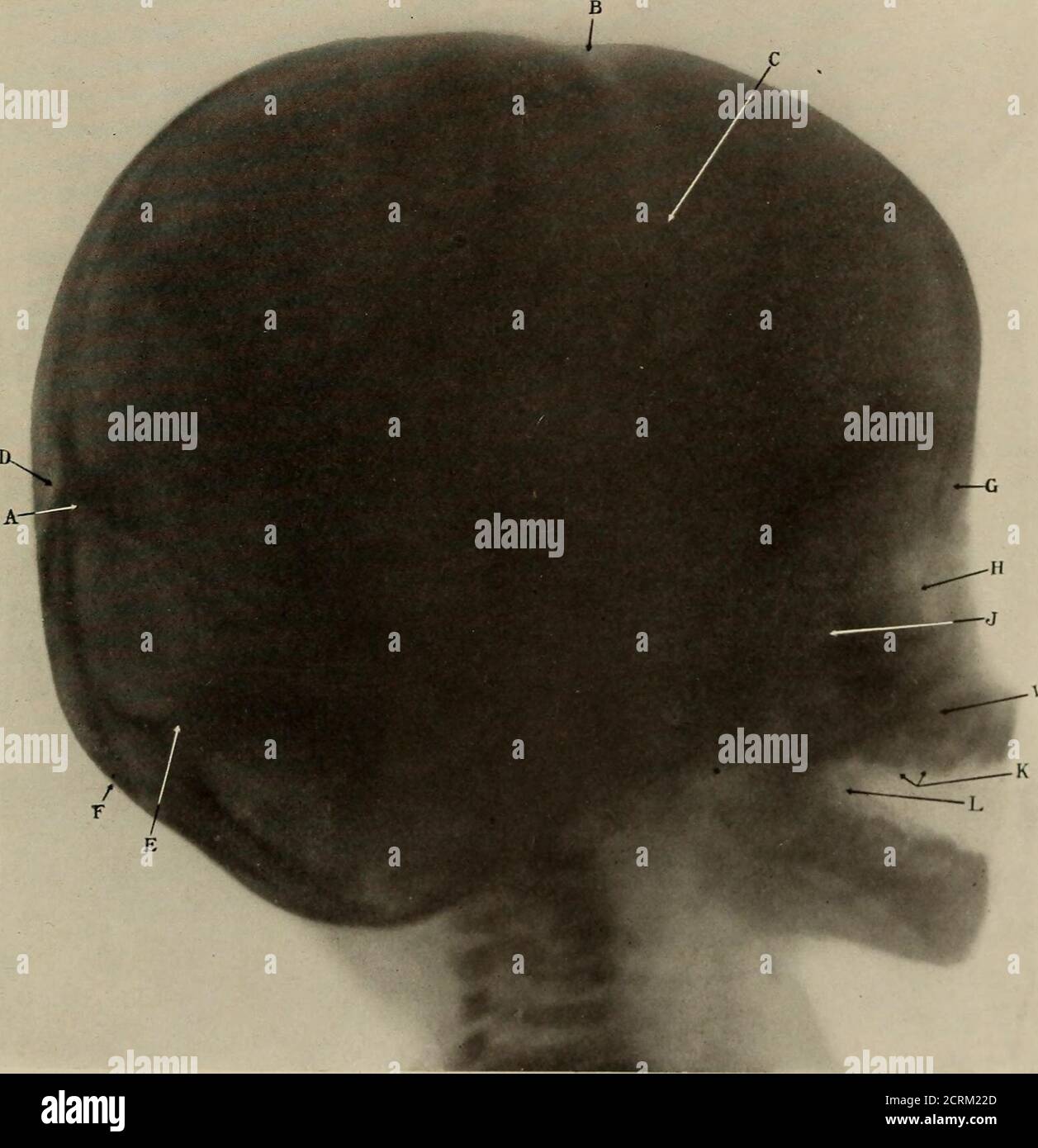 . Living anatomy and pathology; . PLATE 3. Age 10 days. (Reduced 30