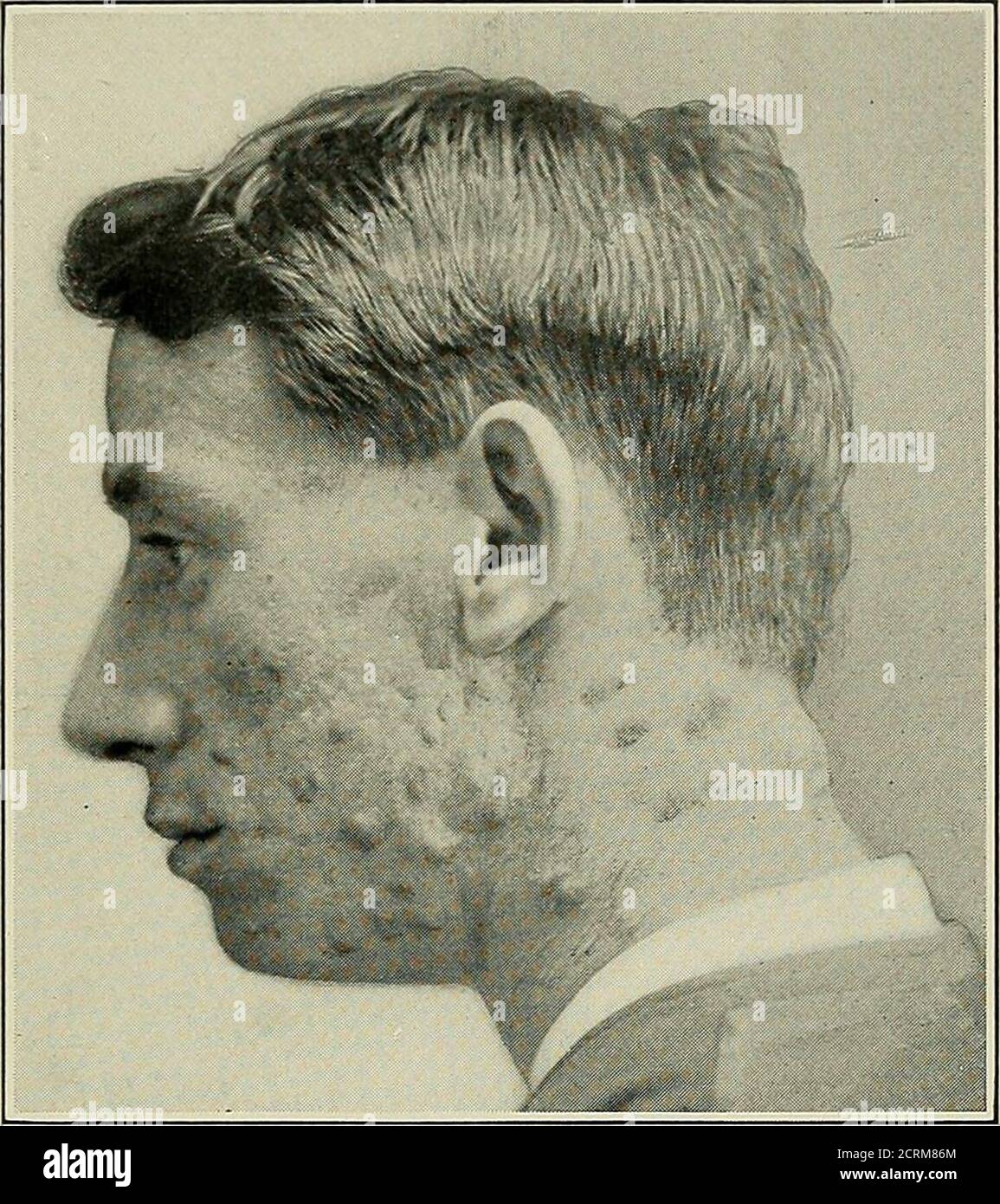 Men Extracting Radium The discovery of radium hi-res stock photography and images - Alamy