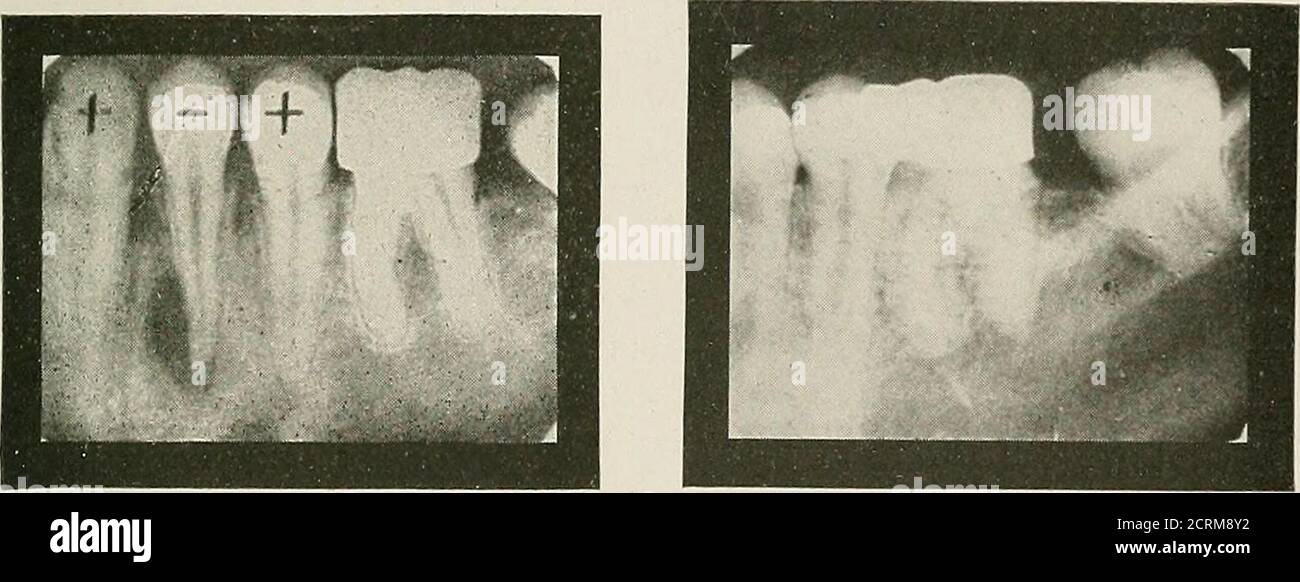 Radiographic detail hi-res stock photography and images - Alamy