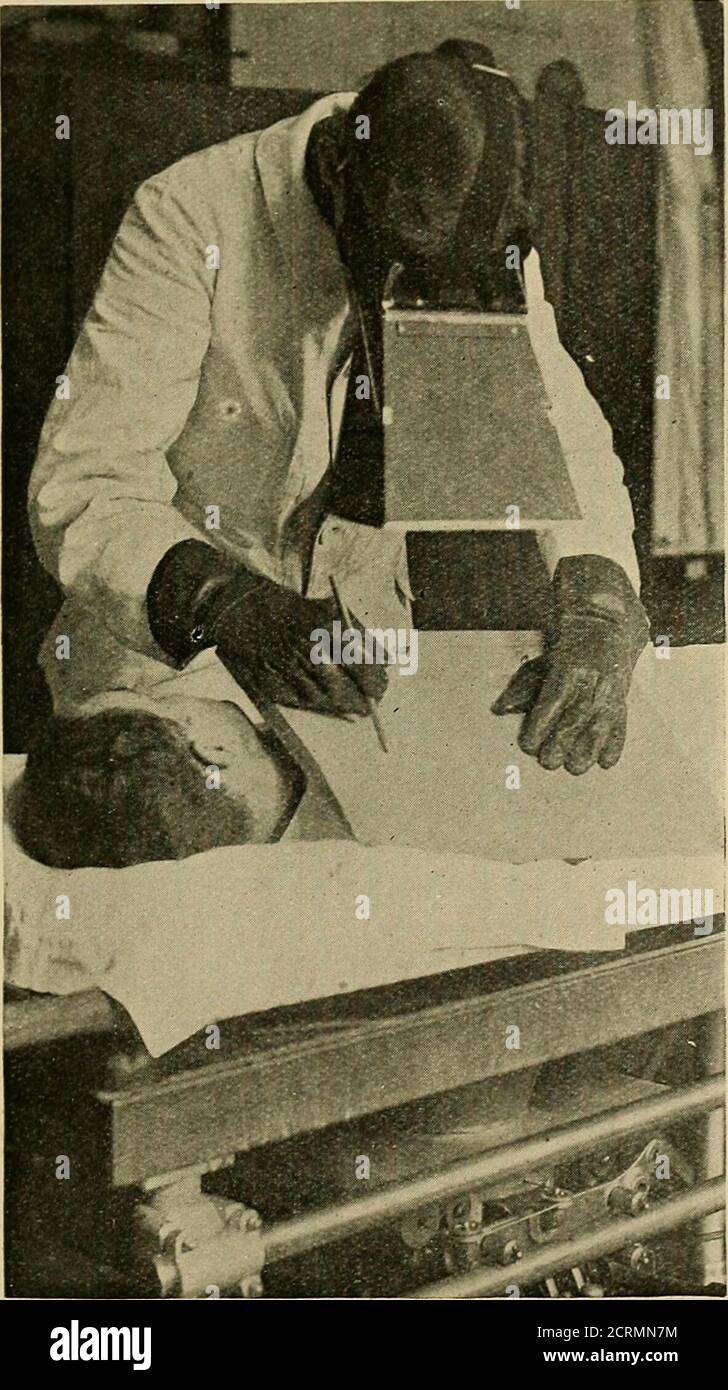 X-ray observations for foreign bodies and their localisation . ^ afterwards  beretraced on to paper. In this way a great economy of platesmay be  effected, and, in most cases, an equal