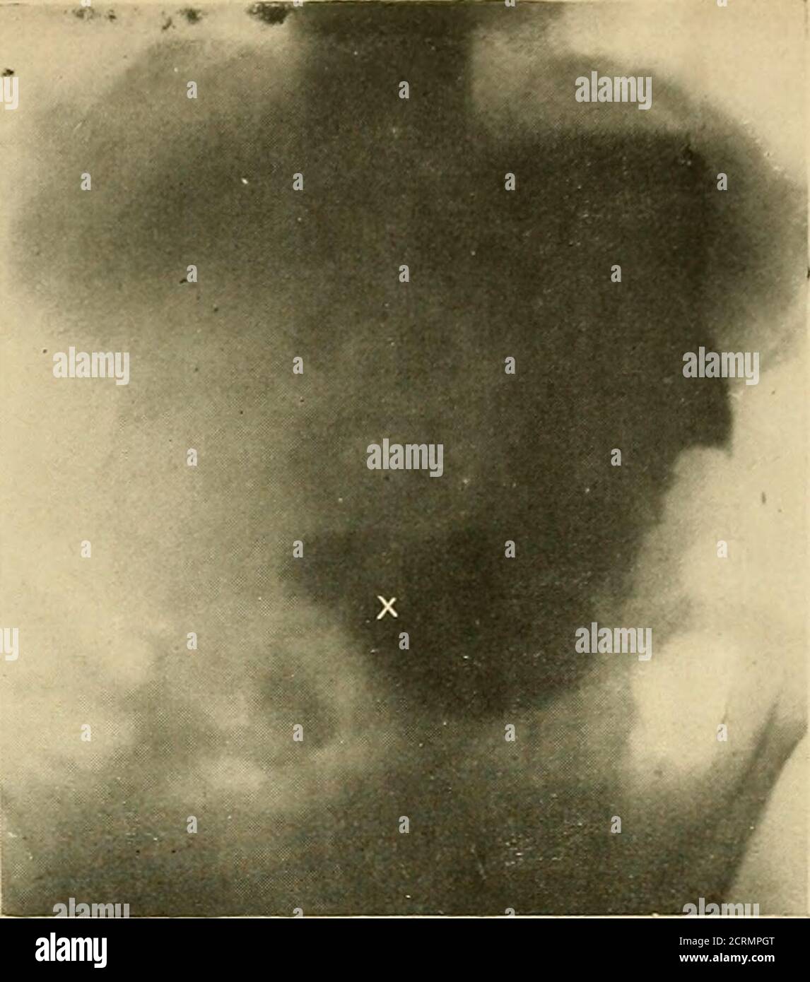 . The alimentary tract : a radiographic study . ced that they are ...
