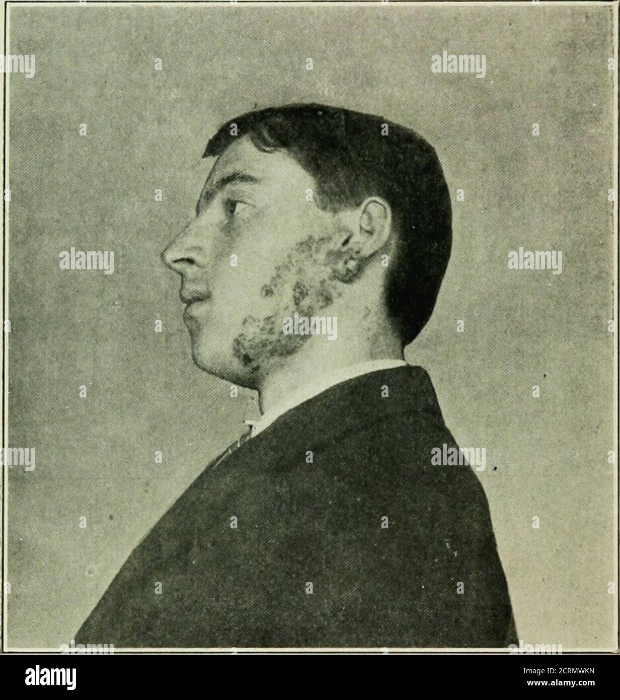 . A manual of electrostatic modes of application, therapeutics