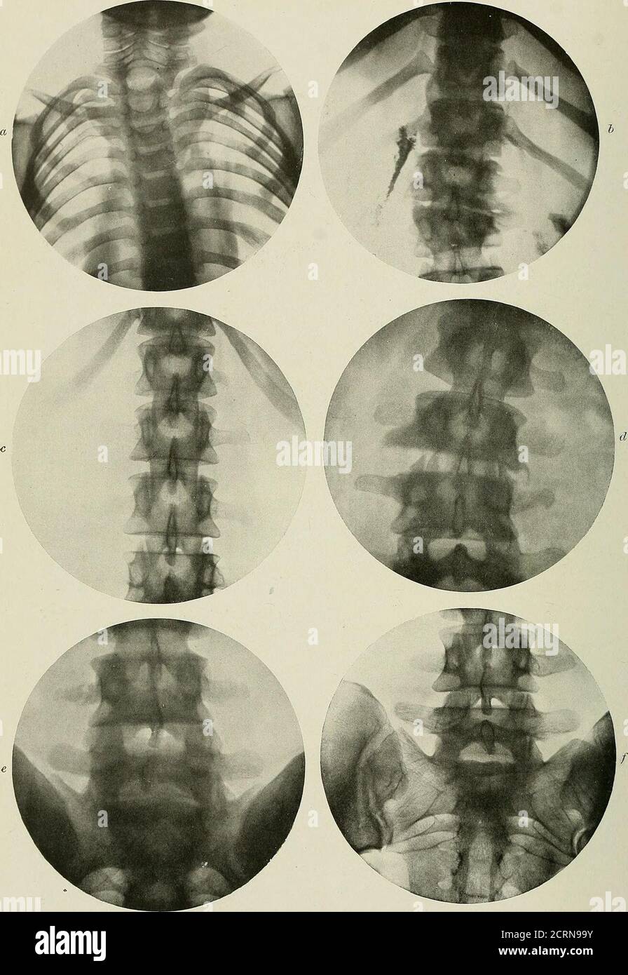 . Radiography and radio-therapeutics . PLATE XXXIX.—Diseases of the ...