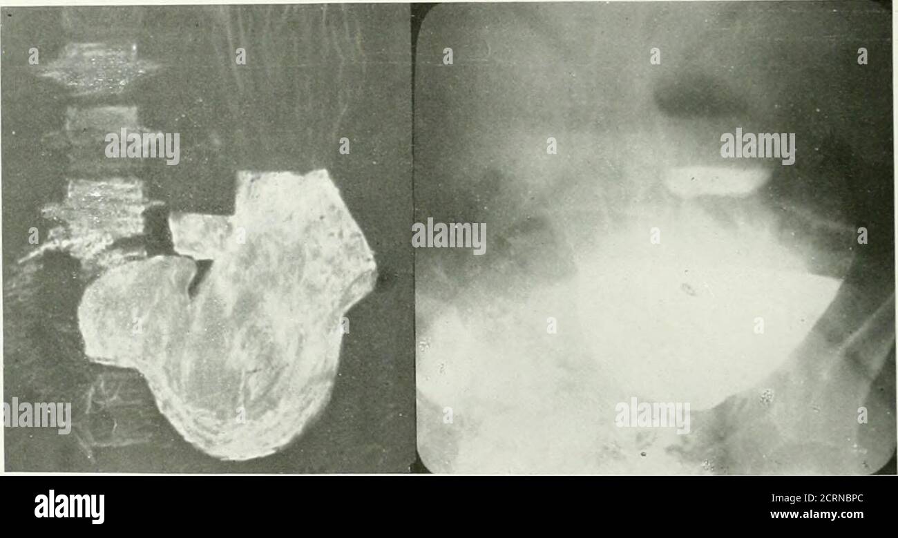. The American journal of roentgenology, radium therapy and nuclear ...