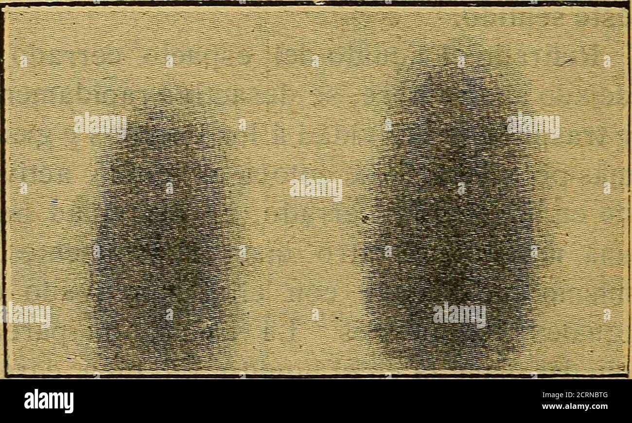 . El radium y la radiografia . Radiografía délos huesos de la mano,obtenida por Chappins I. Acción de los rayos Róntgen sobre una pequeña chispaeléctrica — La que en la fotografía ha aparecido en-grandecida es la que ha recibido la acción. 117 solución de radium y ya. convertido en fosfo-rescente, ponemos cierta cantidad de agua,la parte del tubo situada debajo del agua per-manece sólo fosforescente, y si entonces da-mos una vuelta al tubo, se hace fosforescen-te el agua y la parte superior deja de serlo;pero, luego, poco á poco, pierde el agua lafosforescencia y la adquiere otra vez el vi-dri Stock Photo