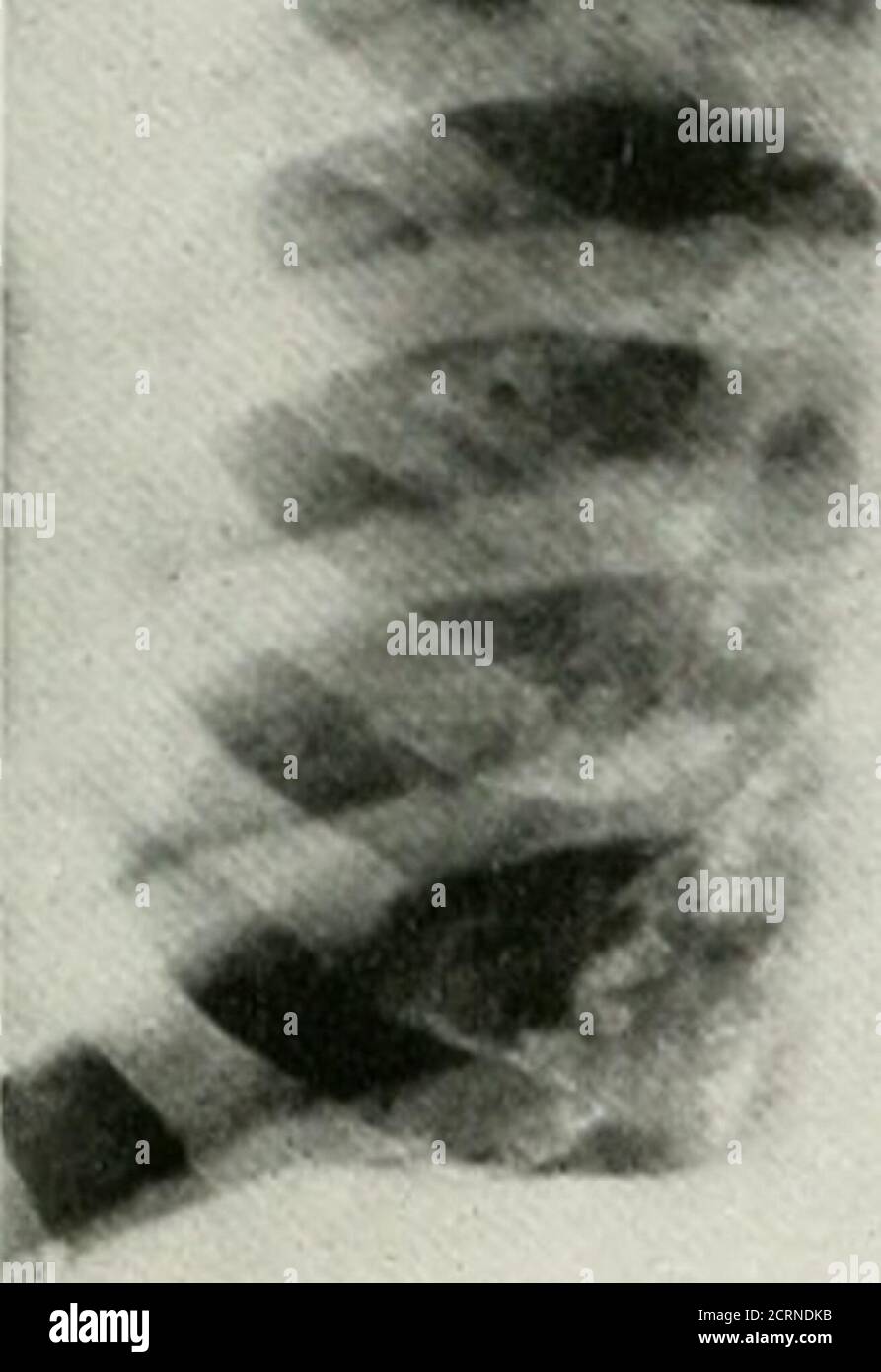 . The American journal of roentgenology, radium therapy and nuclear medicine . Stock Photo