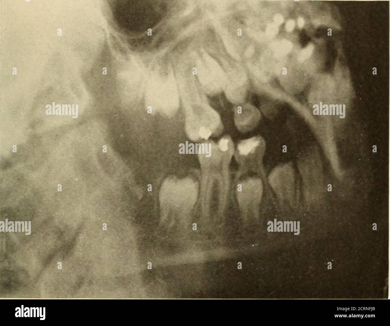 Oral Roentgenology : a Roentgen study of the anatomy and pathology of ...