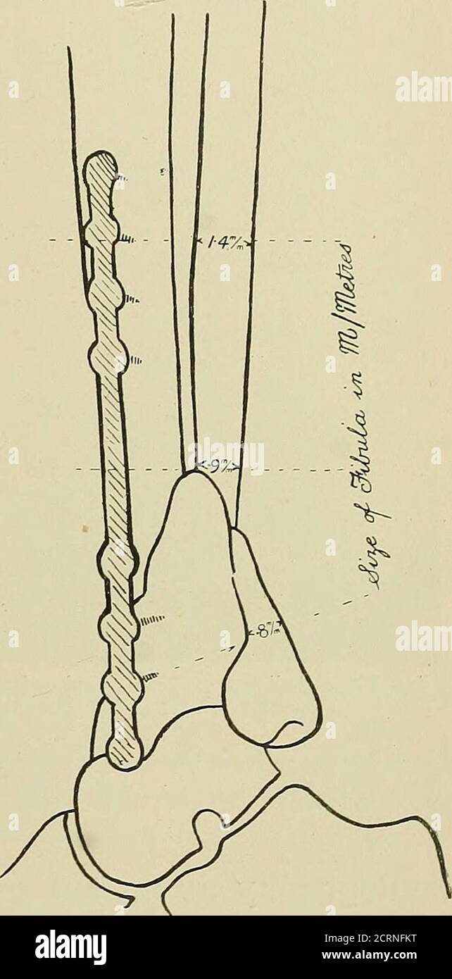 Method of triangulation hi-res stock photography and images - Alamy