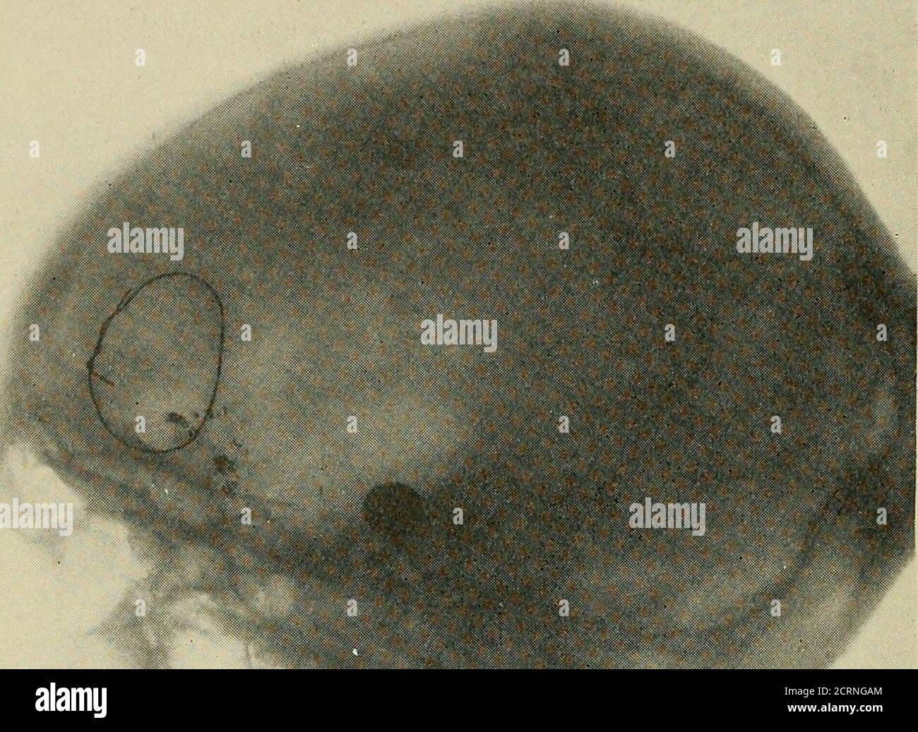 . Radiography and radio-therapeutics . 186 RADIOGKAPHY. Fig. 159 ...