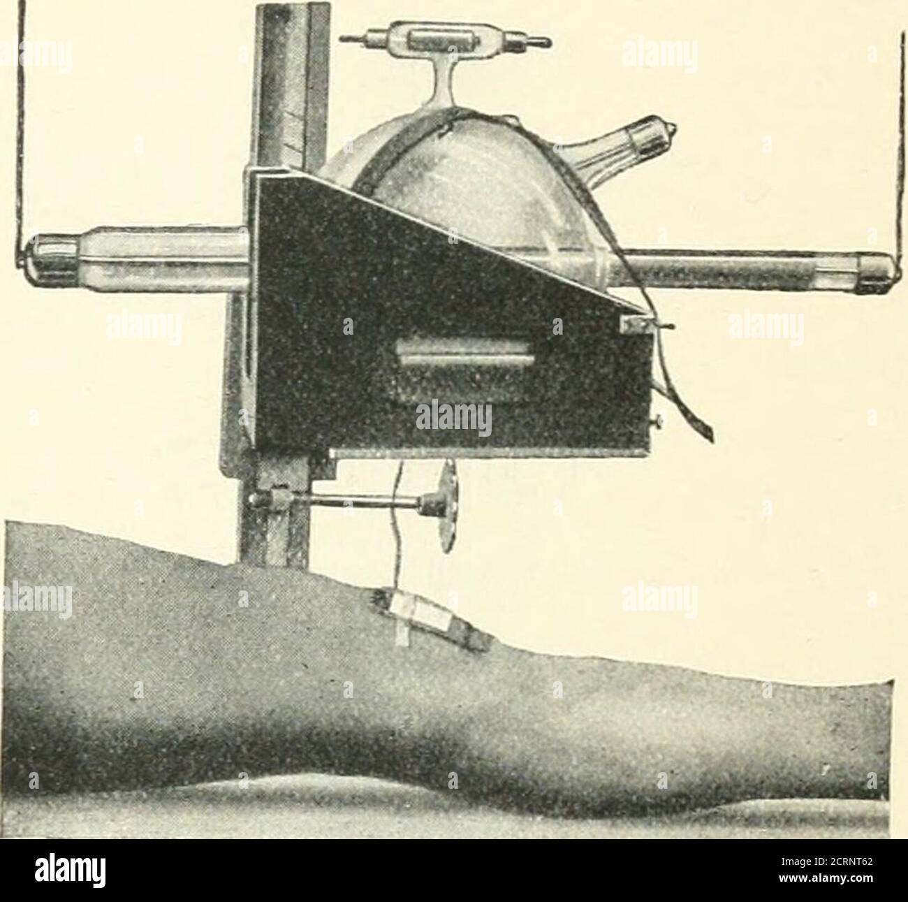 . Radiography, x-ray therapeutics and radium therapy . for Exposure ...