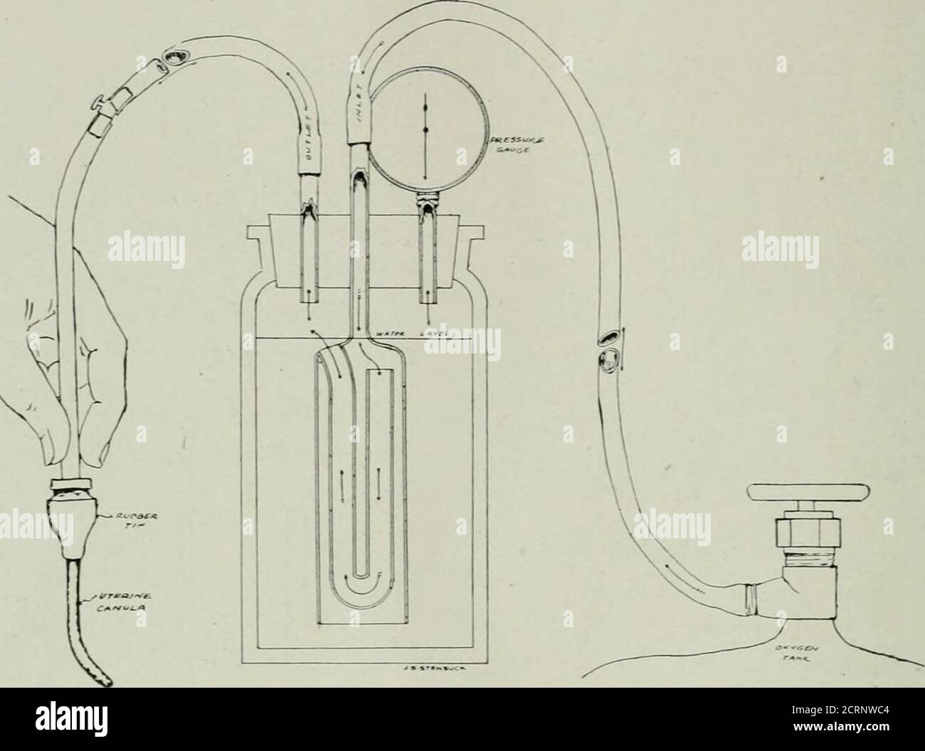 The American Journal Of Roentgenology Radium Therapy And Nuclear Medicine Th It Is An Aid And Is Wellcombined With The Needle Valve Relief Figure2 Represents The Apparatus As Assembledfrom The The American Journal Of Roentgenology Radium Therapy And Nuclear Medicine Th It Is An Aid And Is Wellcombined With The Needle Valve Relief Figure2 Represents The Apparatus As Assembledfrom The