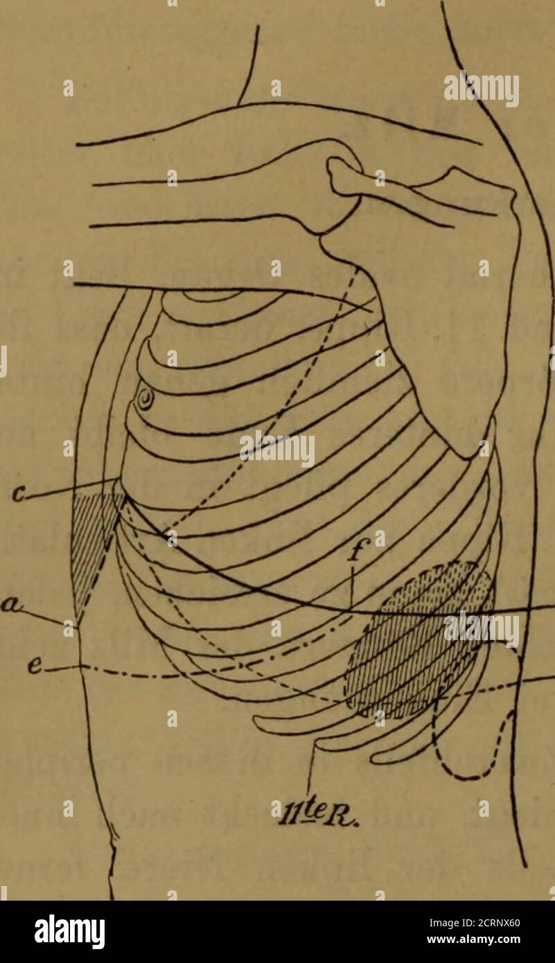 Page 3 Milz High Resolution Stock Photography And Images Alamy