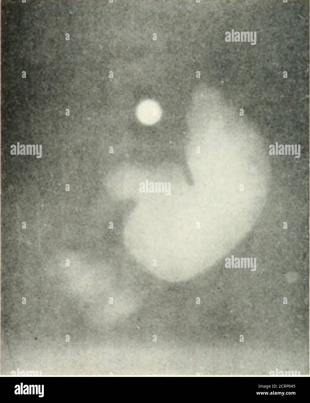 . Radiography, xray therapeutics and radium therapy Stock Photo Alamy