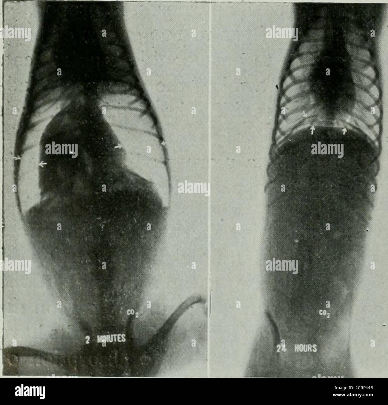 . The American journal of roentgenology, radium therapy and nuclear
