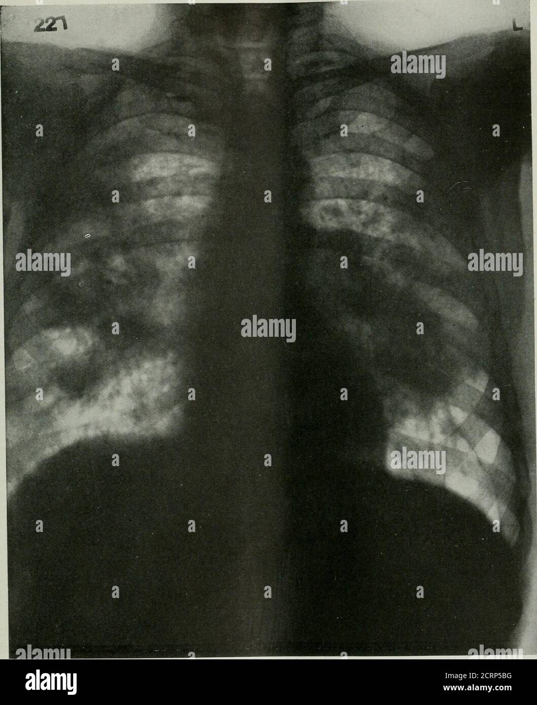 The American journal of roentgenology, radium therapy and nuclear