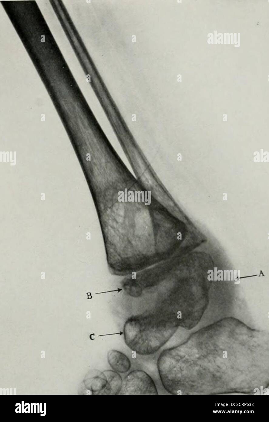 . Living anatomy and pathology; the diagnosis of diseases in early life ...
