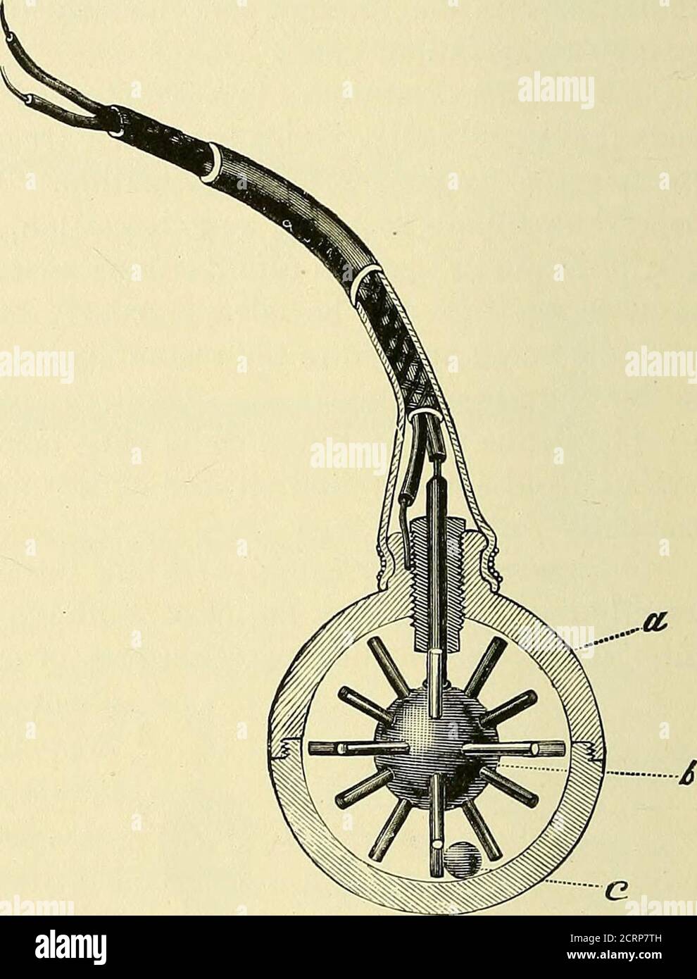 Gastric ball hi-res stock photography and images - Alamy