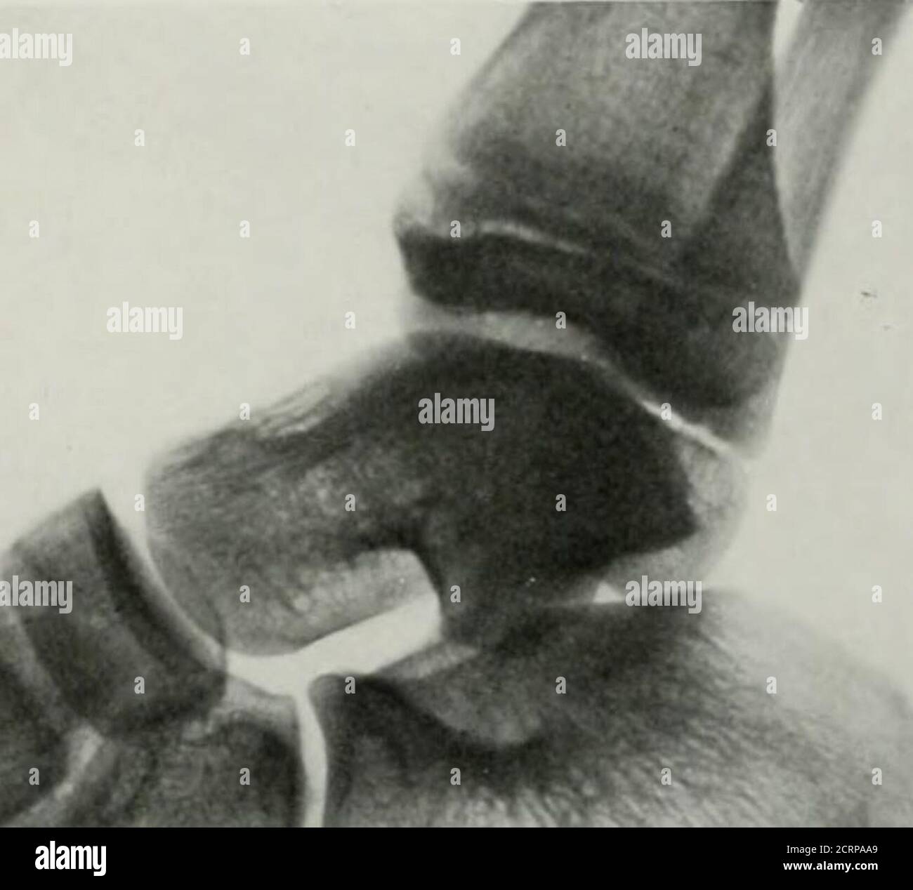 . Living anatomy and pathology; the diagnosis of diseases in early life ...