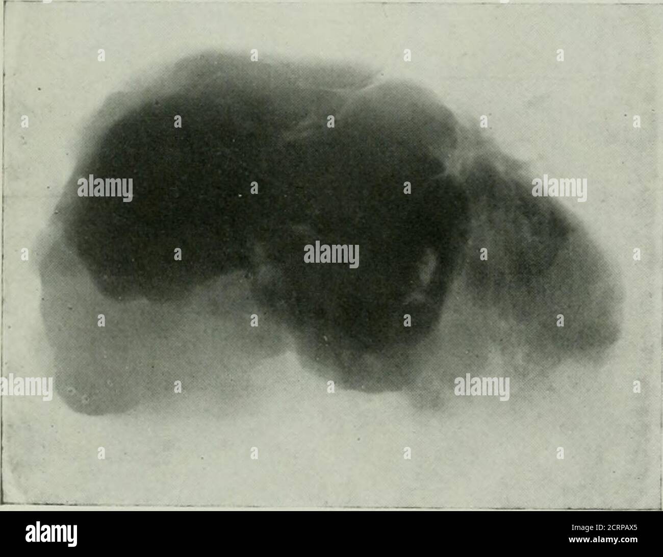 . The American journal of roentgenology, radium therapy and nuclear ...