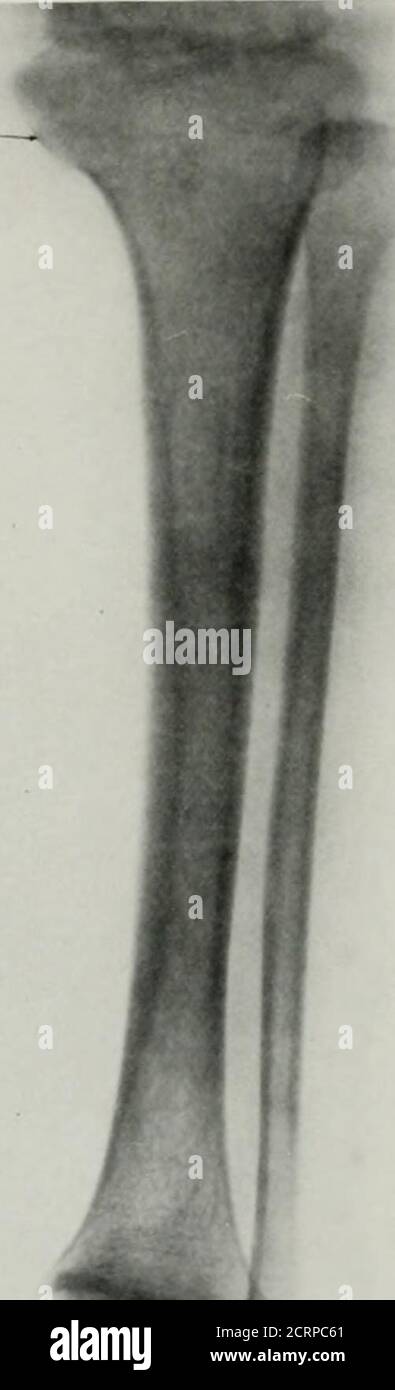 . Living anatomy and pathology; the diagnosis of diseases in early life ...