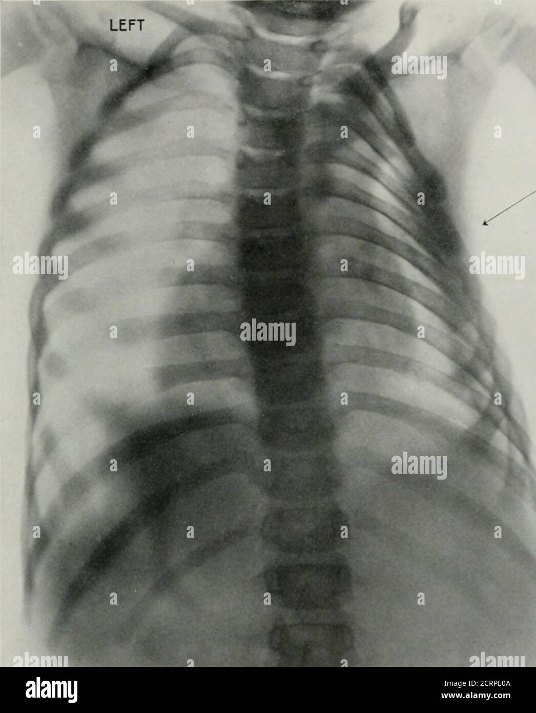. Living anatomy and pathology; the diagnosis of diseases in early life ...