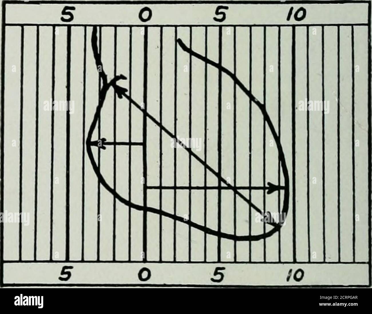 . The American journal of roentgenology, radium therapy and nuclear medicine . e from the same subjecttaken in inspiration (Figs. 11 and 12), sothat the shadows of the metallic markersupon the backs coincided and the shadowsof the vertical rods on the sternum were par-allel, the changes taking place in the shapeand position of the heart during deep respir-ation could be readily seen. It should beborne in mind that every exposure in eachseries was made during the same phase ofthe cardiac cycle. This was usually one-fifthof a second after the pulse wave arrived atthe wrist, but some were set off Stock Photo