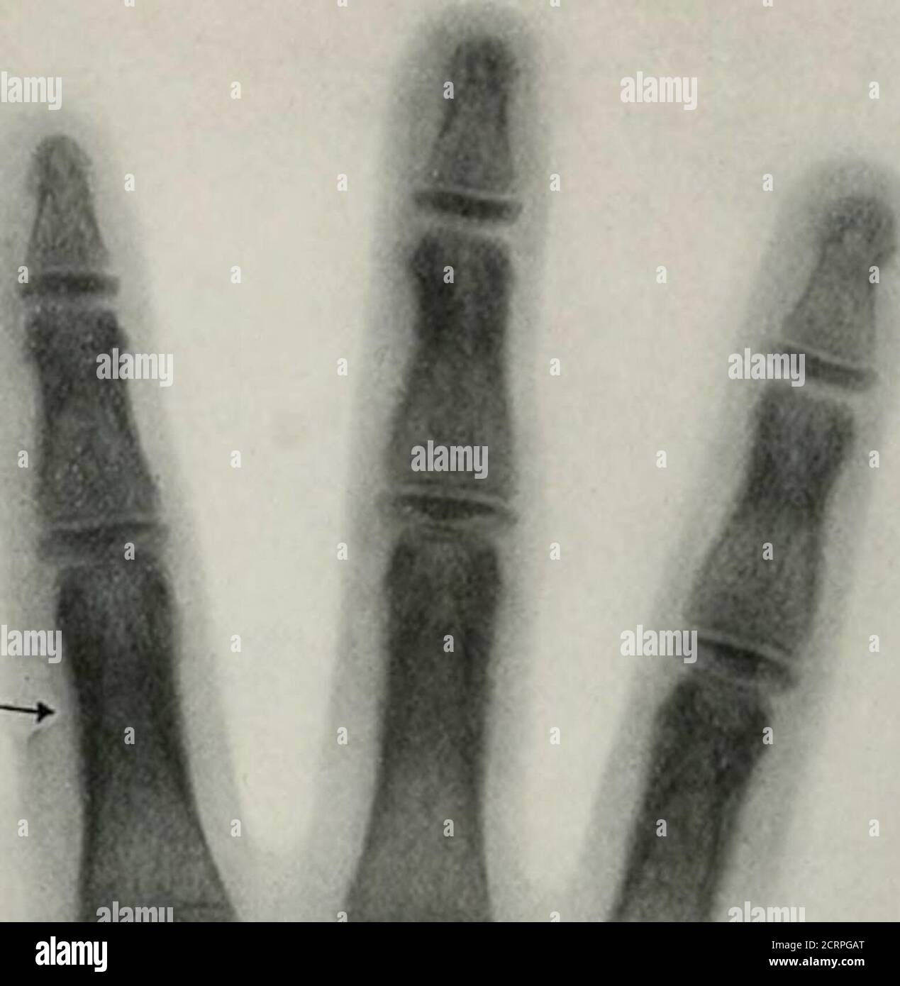 . Living anatomy and pathology; the diagnosis of diseases in early life by the Roentgen method . •■^- Stock Photo