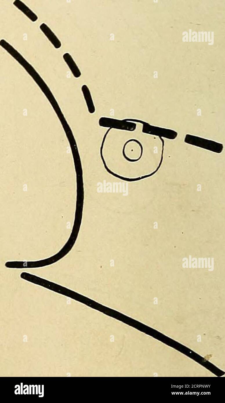 Normal liver x ray hires stock photography and images Alamy