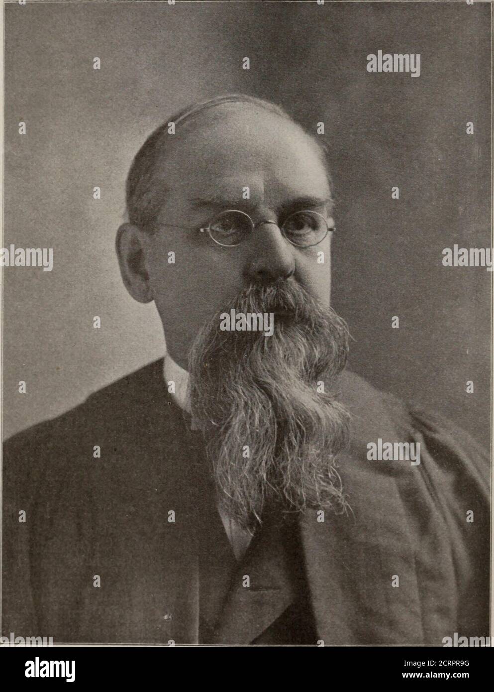 X ray hair removal hires stock photography and images Alamy