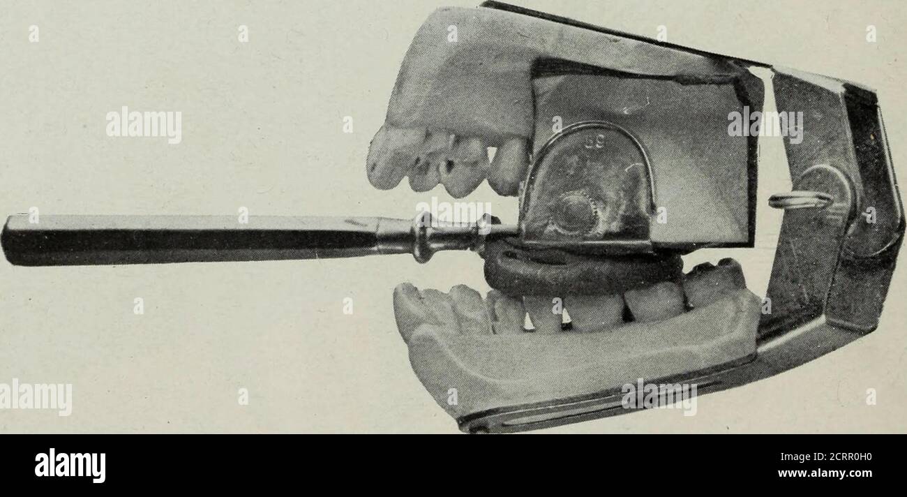 Elementary and dental radiography . Fig. 332. The film holder shown in Fig.  331 in position.. Fig. 333. Another view of the film holder in position.  STIiRliOSCOriC R.lDIOCRArilY 305 It is