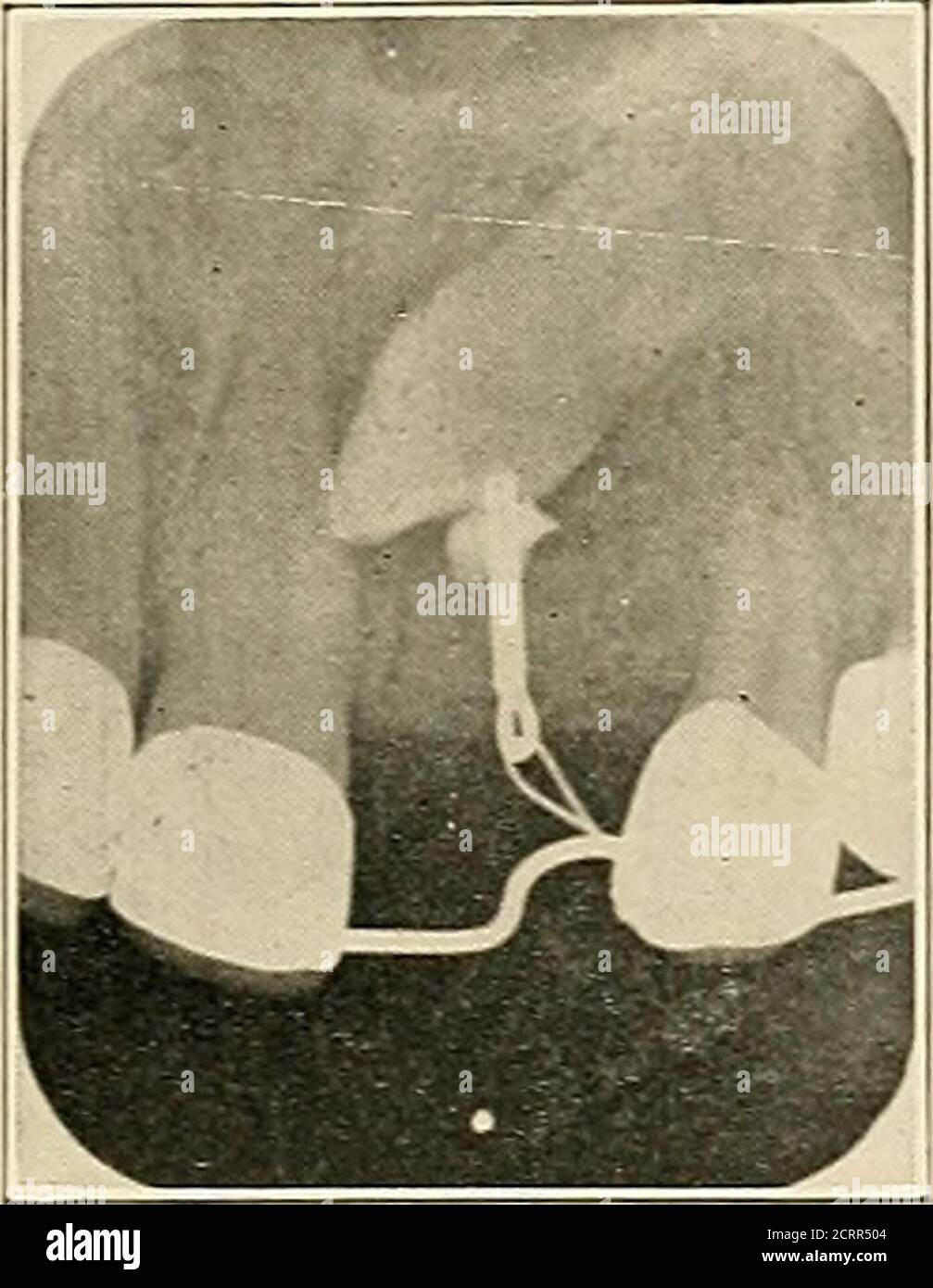 . Dental and oral radiography a textbook for students and
