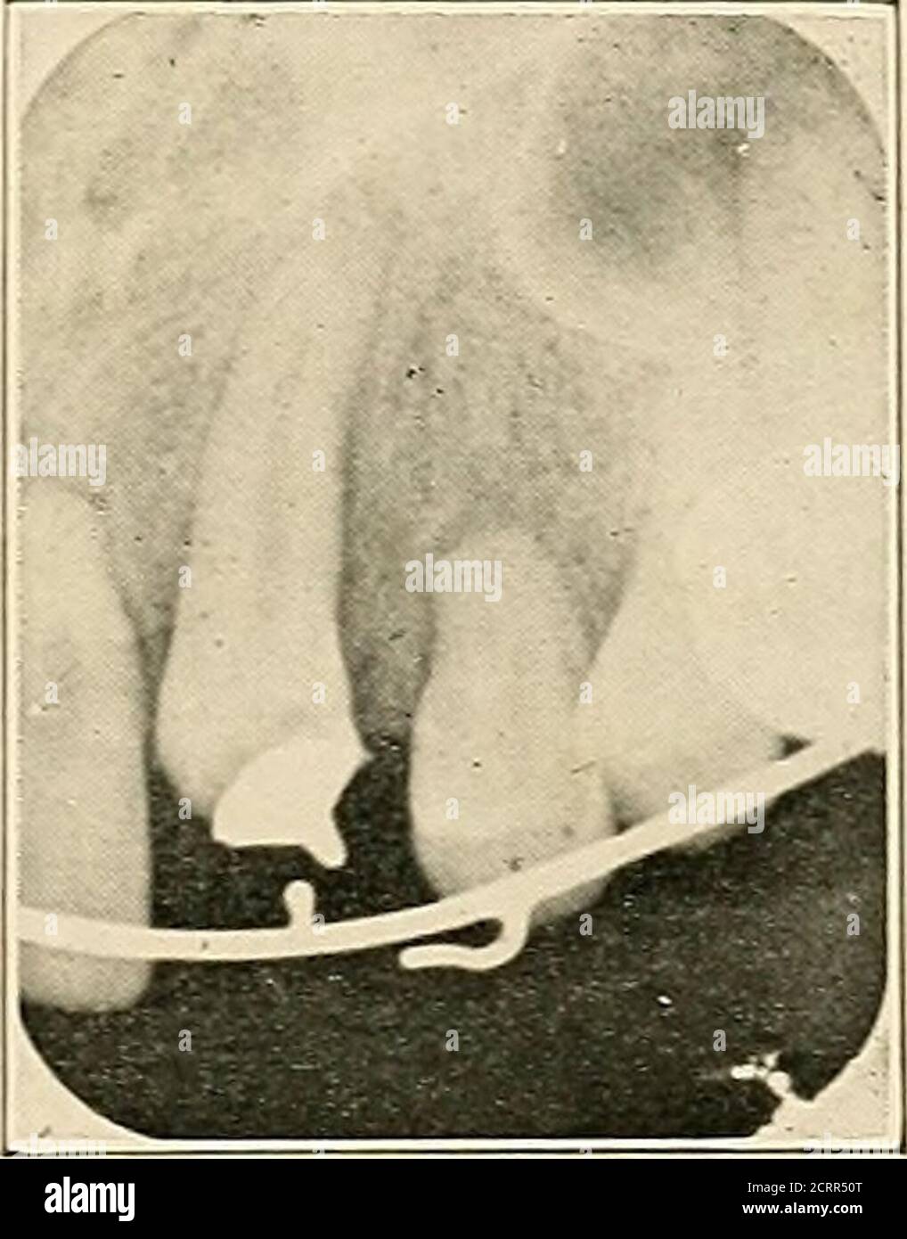 Bookiddentaloralra hi-res stock photography and images - Alamy
