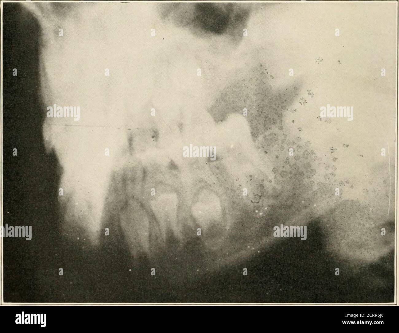 . Dental and oral radiography : a textbook for students and ...
