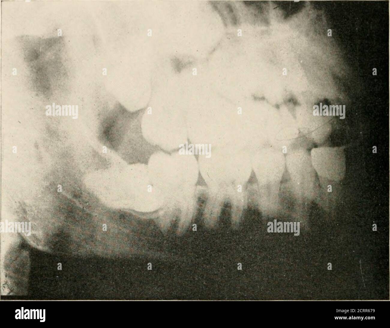 . Dental and oral radiography : a textbook for students and ...