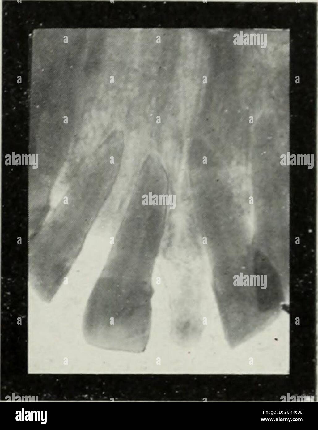 . Elementary and dental radiography . Fig. 201. Fig. ?ri2. Fig. 261