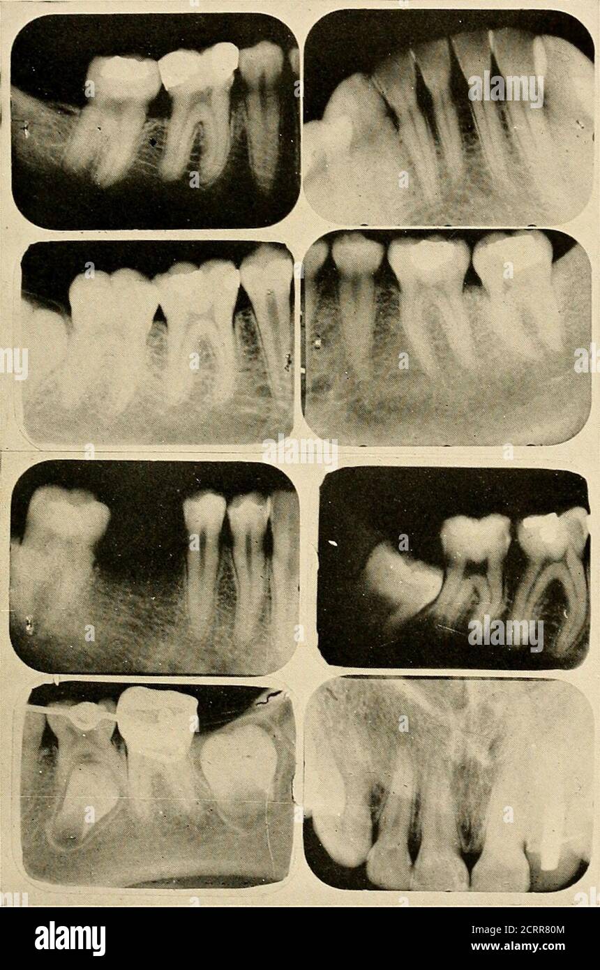 . Dental and oral radiography : a textbook for students and ...