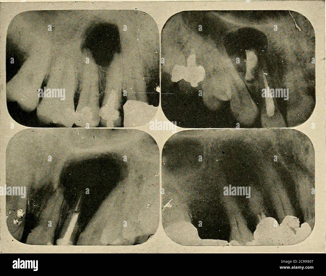 The result of dental radiography hires stock photography and images Alamy