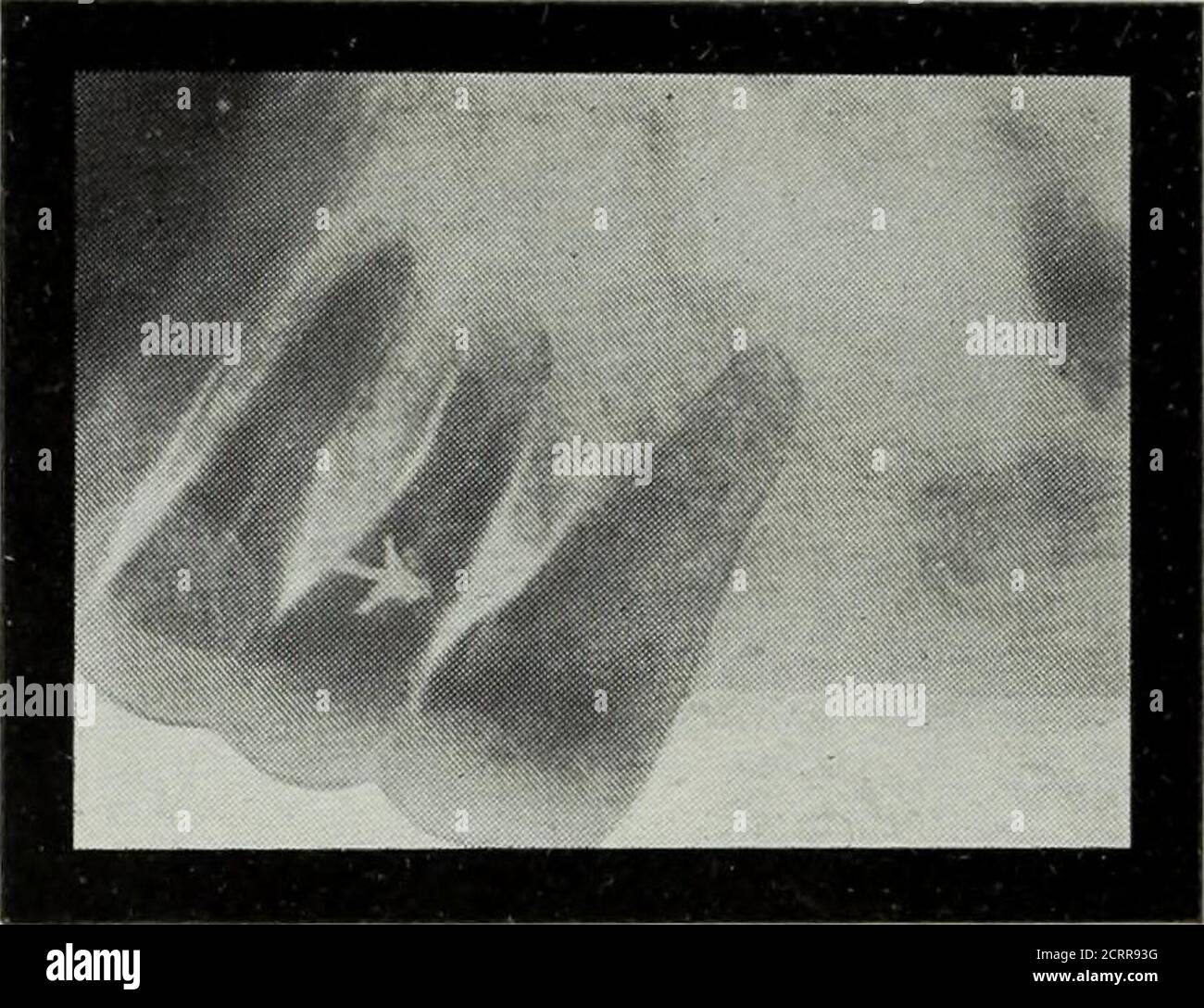 . Elementary and dental radiography . Fig. 205 Pis: 20(1 Fig. 205. The ...