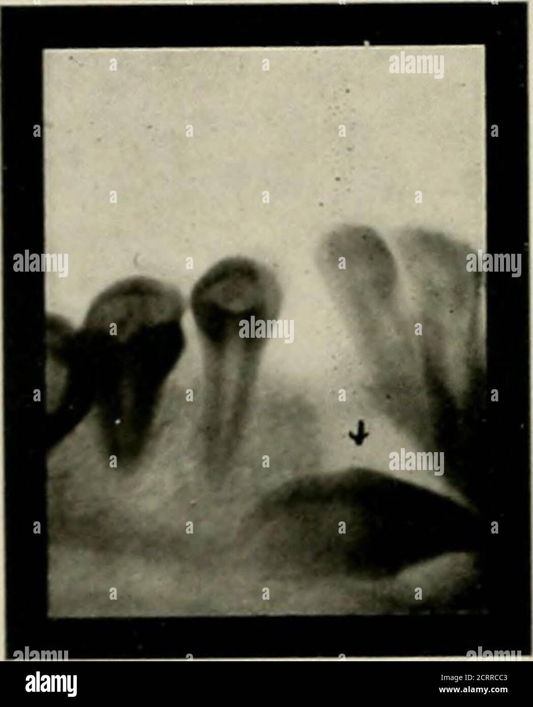 Elementary And Dental Radiography R Tion Ery Escent Proved Proved Data Manic Depressive Type 11 9 5 2 2 Dementia Precox 10 8 5 1 2 Psychosis Elementary And Dental Radiography R Tion Ery Escent Proved Proved Data Manic Depressive Type 11 9 5 2 2 Dementia Precox 10 8 5 1 2 Psychosis