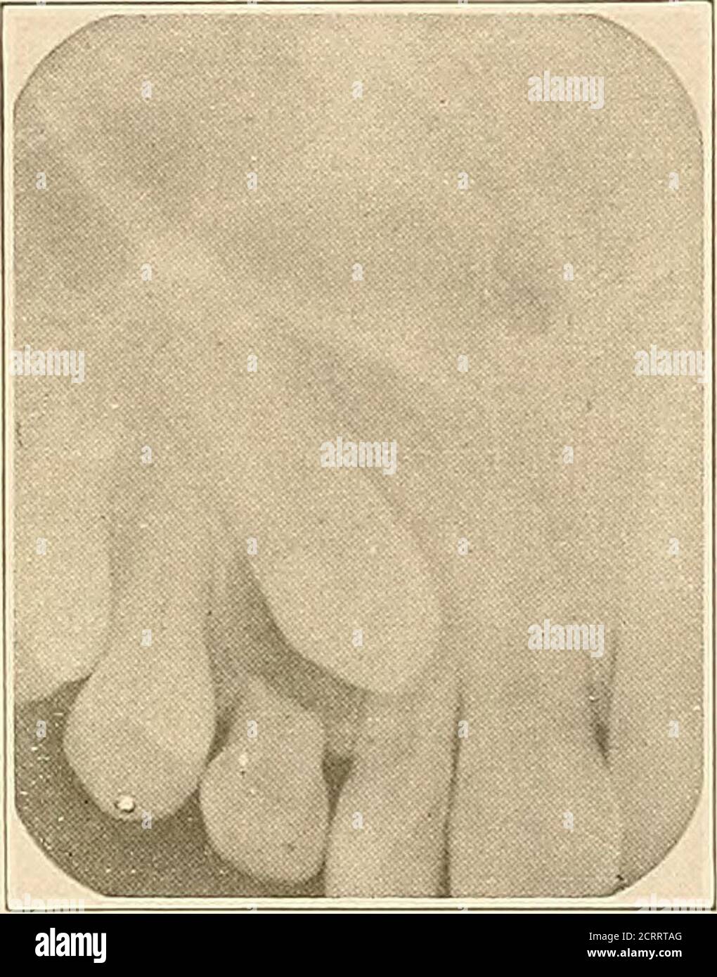 . Dental and oral radiography a textbook for students and