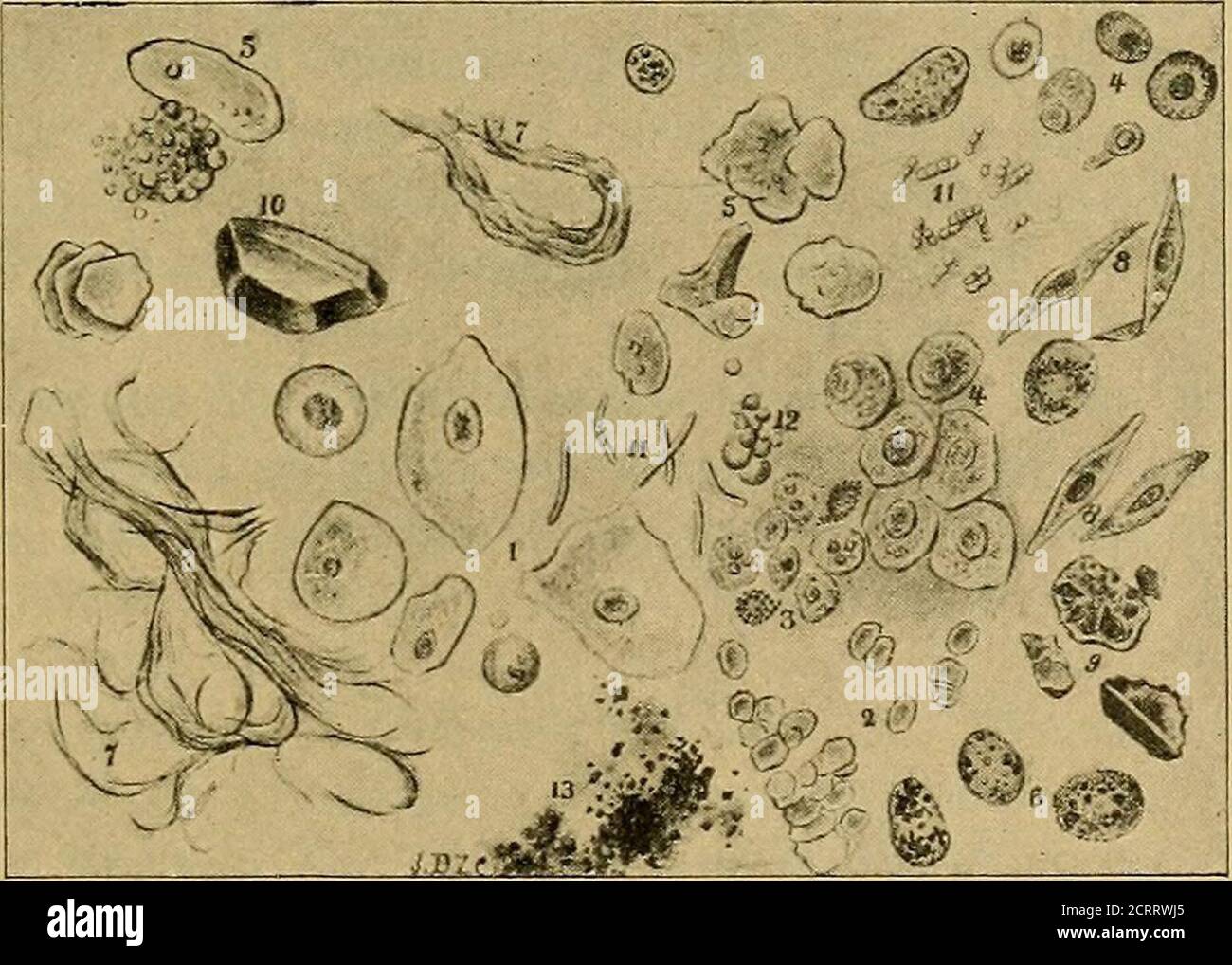 Alveolar epithelium High Resolution Stock Photography and Images Alamy