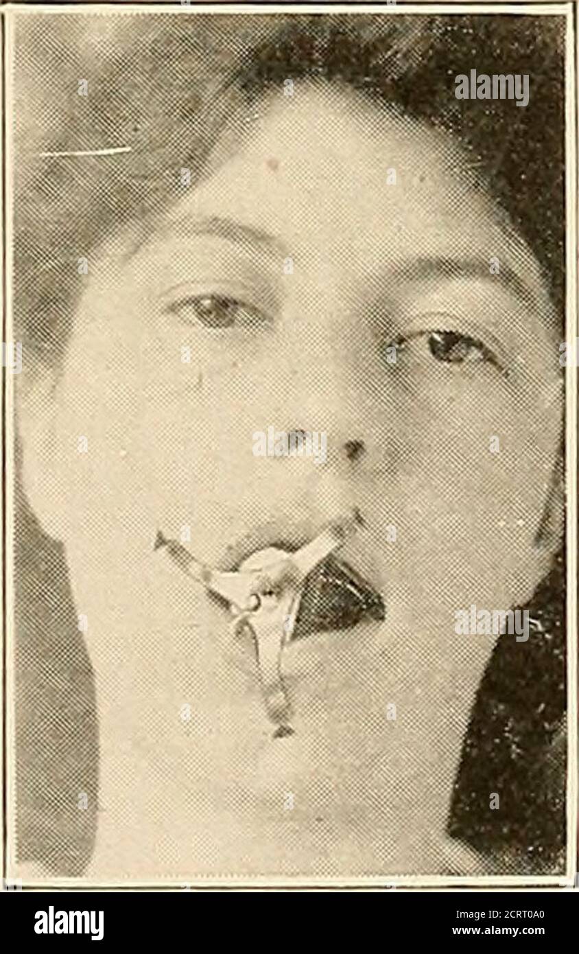 . Dental and oral radiography a textbook for students and