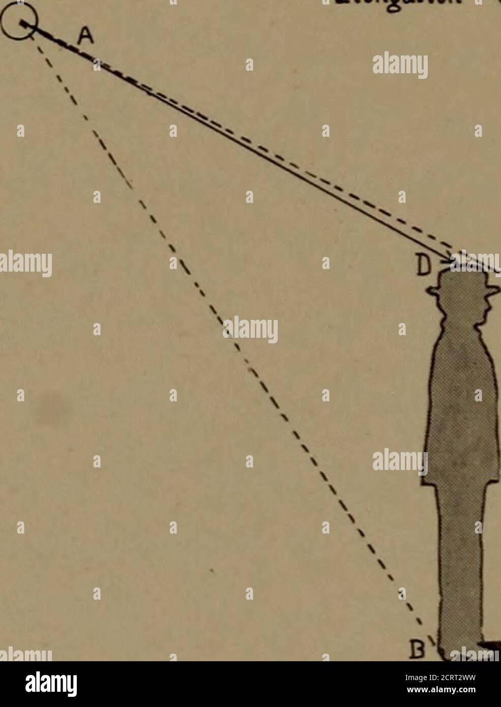 . Dental radiology . H Fig.14 Fig. 15. Fig. 16.. Elongation Oj Shadows. Fig.17 100 You will