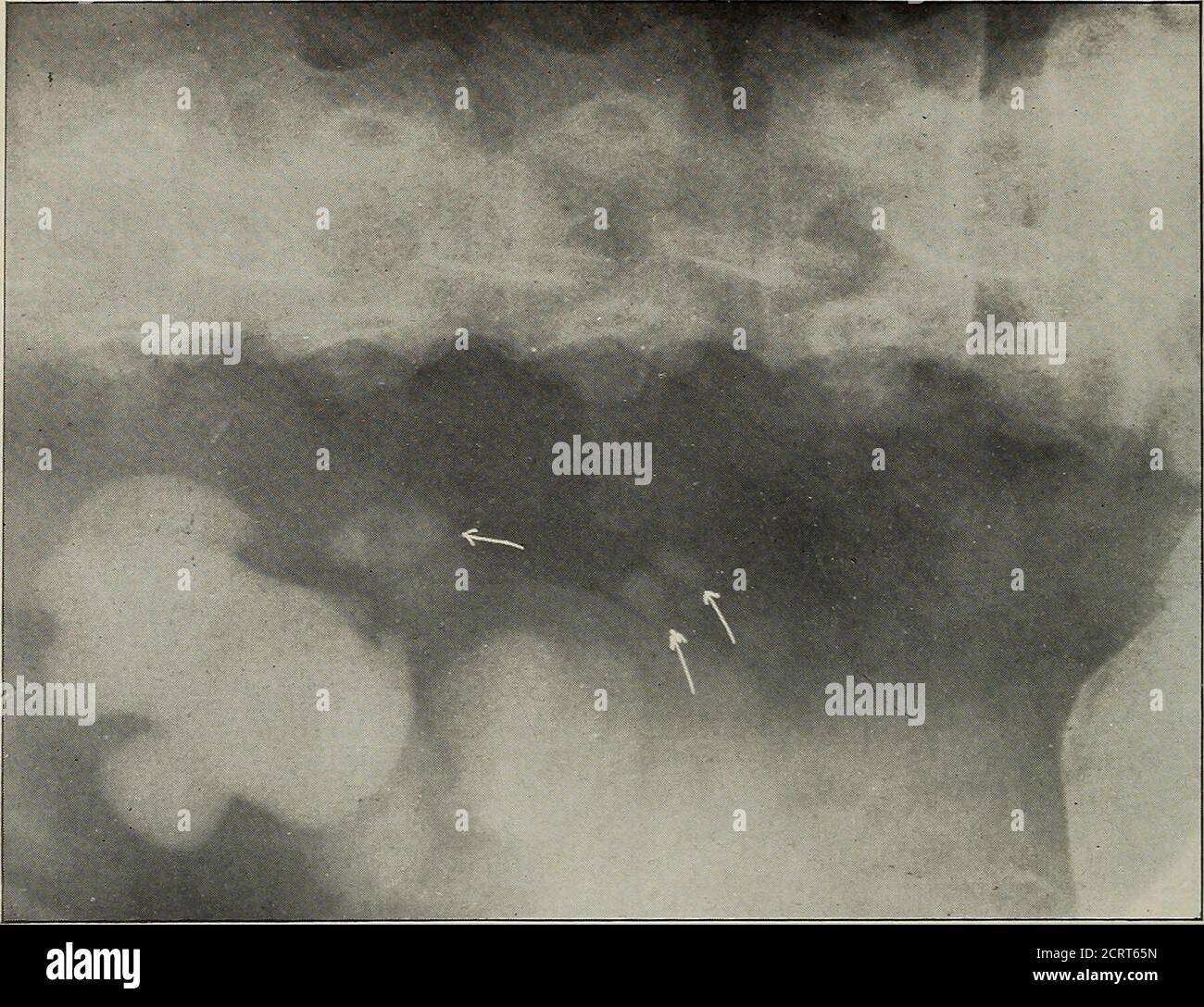American Quarterly Of Roentgenology Be Gt A C C Tfj O 3 9 O Gt V U A C 3 Aj W O T Gt M