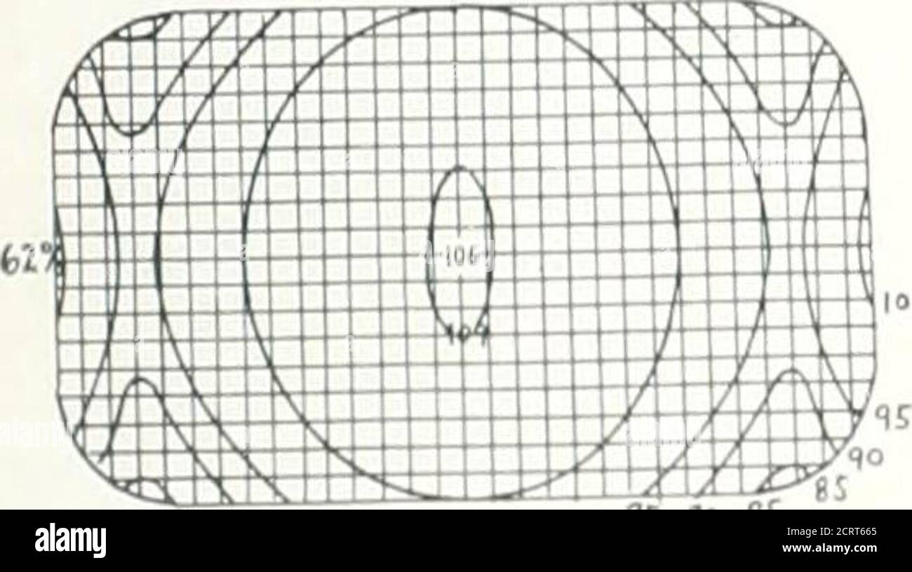 . Archives of physical medicine and rehabilitation . Fit9 Cross Section, ofra^fiaied Volume. Fie/di. Front,back Ii tiScm. n(lht.left,2M ft Cmr Focus-skirt distance 3o cm Absorption coefficient 0.141 Cross Seciiorv of Radiated VolumeFieldy.Frcnt.bnik Z4iiScm^. Ritjht-left Zl-f-lcm^FocuiSkin distance 30 on .Absorpticn. CoeFficifnf- O.I40. FIG. 10 ■^ ^ Cross section of RaUlaied Volume.Fitlcfs: front^hack20.1 X Zt.lcm ncjhtjeff I0%2(,.licFocuSSkin distance SOcuv.Rhsorption Coefficifnt 0.1^9 Stock Photo